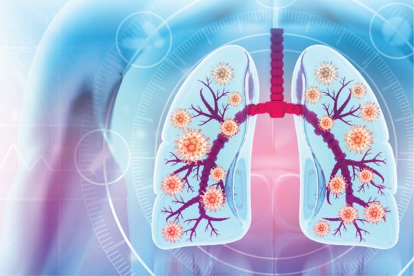 Graphic showing someone's chest with their lungs